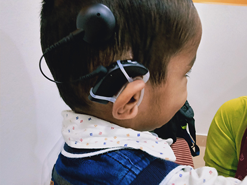 Cochlear Implant In Hyderabad